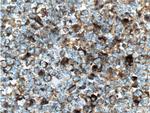 HMMR Antibody in Immunohistochemistry (Paraffin) (IHC (P))
