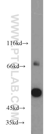 HMMR Antibody in Western Blot (WB)