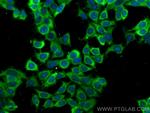 PKM2 Antibody in Immunocytochemistry (ICC/IF)