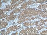 PKM2 Antibody in Immunohistochemistry (Paraffin) (IHC (P))