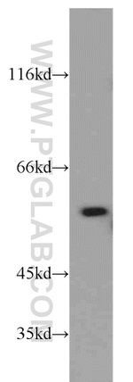 PKM2 Antibody in Western Blot (WB)