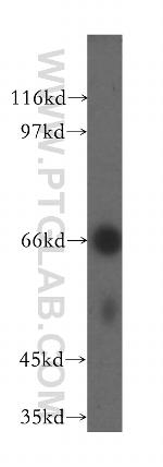 UBASH3A Antibody in Western Blot (WB)