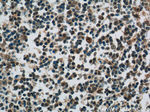 MCL1L Antibody in Immunohistochemistry (Paraffin) (IHC (P))