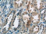 domain-I-of-FIZ-1 Antibody in Immunohistochemistry (Paraffin) (IHC (P))