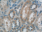 domain-I-of-FIZ-1 Antibody in Immunohistochemistry (Paraffin) (IHC (P))