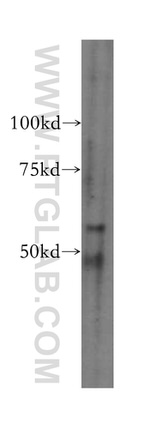 domain-I-of-FIZ-1 Antibody in Western Blot (WB)
