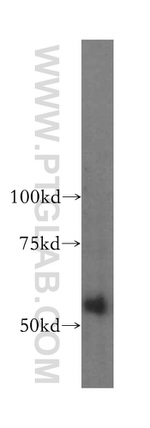 domain-I-of-FIZ-1 Antibody in Western Blot (WB)
