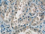 domain-II-of-FIZ1 Antibody in Immunohistochemistry (Paraffin) (IHC (P))