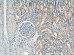 domain-II-of-FIZ1 Antibody in Immunohistochemistry (Paraffin) (IHC (P))