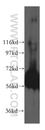 domain-II-of-FIZ1 Antibody in Western Blot (WB)