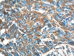 GARS Antibody in Immunohistochemistry (Paraffin) (IHC (P))