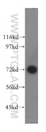 GARS Antibody in Western Blot (WB)