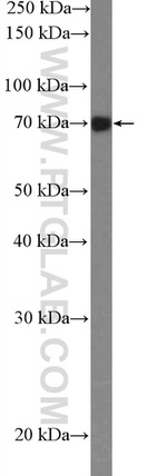 GARS Antibody in Western Blot (WB)
