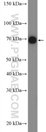 GARS Antibody in Western Blot (WB)