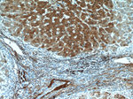 Vitronectin Antibody in Immunohistochemistry (Paraffin) (IHC (P))