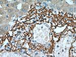Vitronectin Antibody in Immunohistochemistry (Paraffin) (IHC (P))