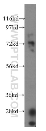 Vitronectin Antibody in Western Blot (WB)