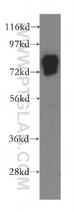 Vitronectin Antibody in Western Blot (WB)