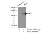 ZPBP Antibody in Immunoprecipitation (IP)