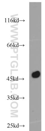 Carboxypeptidase A1 Antibody in Western Blot (WB)