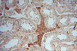 GSTT1 Antibody in Immunohistochemistry (Paraffin) (IHC (P))