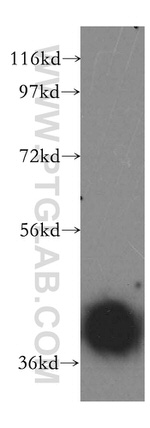 PSMC6 Antibody in Western Blot (WB)