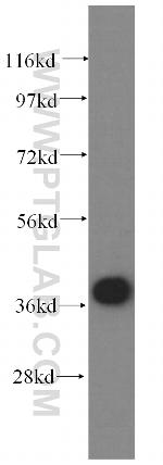 PSMC6 Antibody in Western Blot (WB)