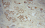 ACPP Antibody in Immunohistochemistry (Paraffin) (IHC (P))