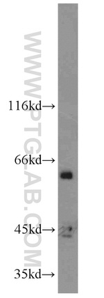 ACPP Antibody in Western Blot (WB)