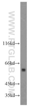ACPP Antibody in Western Blot (WB)