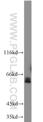 ACPP Antibody in Western Blot (WB)