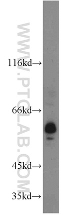 ACPP Antibody in Western Blot (WB)