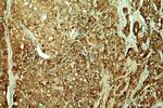 ACPP Antibody in Immunohistochemistry (Paraffin) (IHC (P))