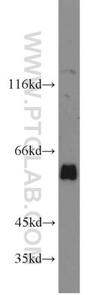 ACPP Antibody in Western Blot (WB)