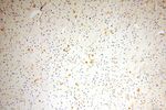 TGM4 Antibody in Immunohistochemistry (Paraffin) (IHC (P))