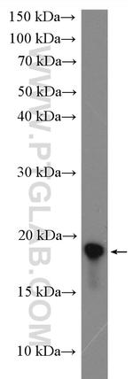 REG Antibody in Western Blot (WB)