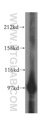 PYGL Antibody in Western Blot (WB)