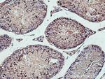 PPP6C Antibody in Immunohistochemistry (Paraffin) (IHC (P))