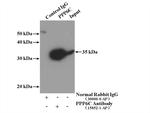 PPP6C Antibody in Immunoprecipitation (IP)