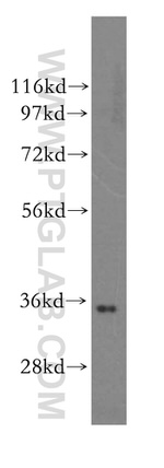 PPP6C Antibody in Western Blot (WB)