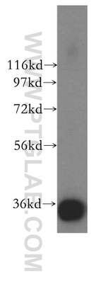 PPP6C Antibody in Western Blot (WB)
