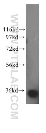 PPP6C Antibody in Western Blot (WB)
