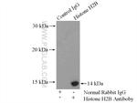 Histone H2B Antibody in Immunoprecipitation (IP)