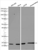 Histone H2B Antibody in Western Blot (WB)