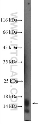 Histone H2B Antibody in Western Blot (WB)