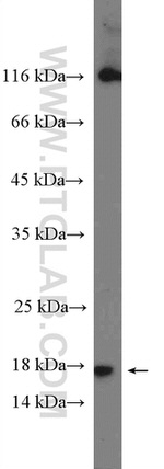 Histone H2B Antibody in Western Blot (WB)