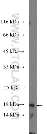 Histone H2B Antibody in Western Blot (WB)