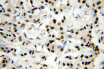 SF3A1 Antibody in Immunohistochemistry (Paraffin) (IHC (P))