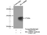 HLA-DRB1 Antibody in Immunoprecipitation (IP)