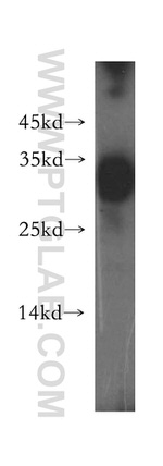 HLA-DRB1 Antibody in Western Blot (WB)